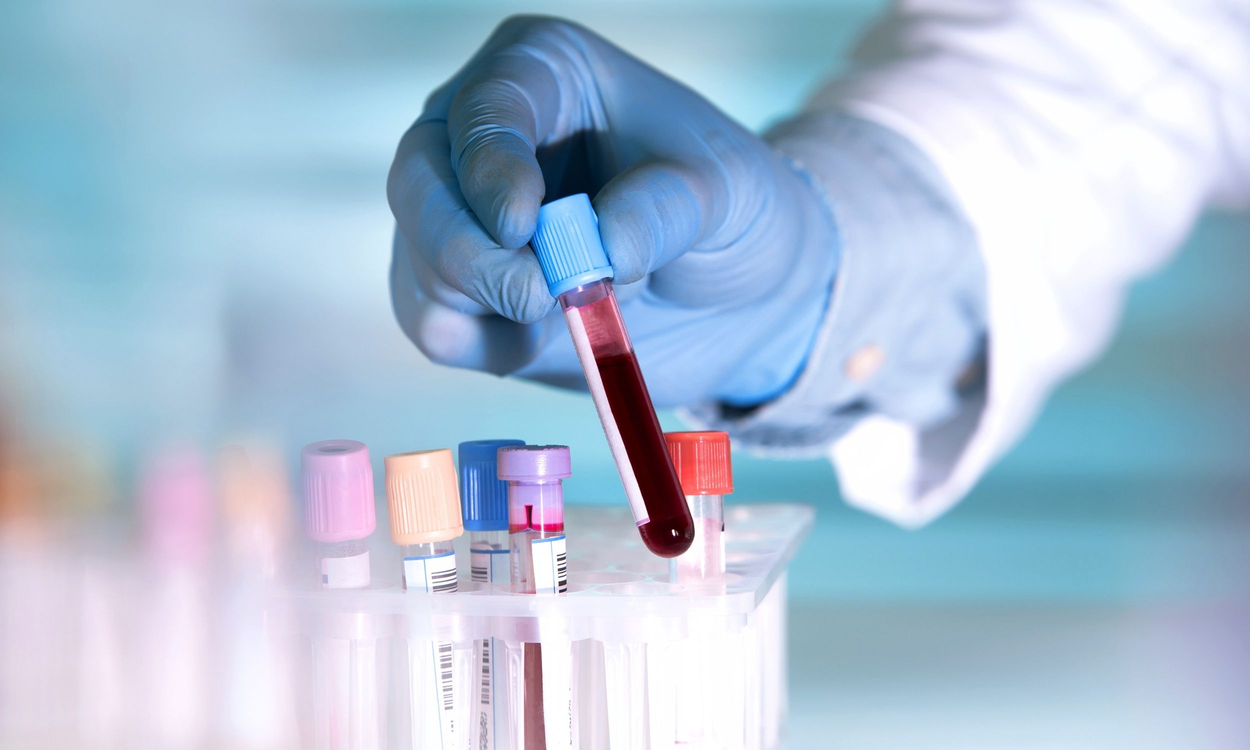 Simple blood test detects cancer up to 3 years symptoms appear