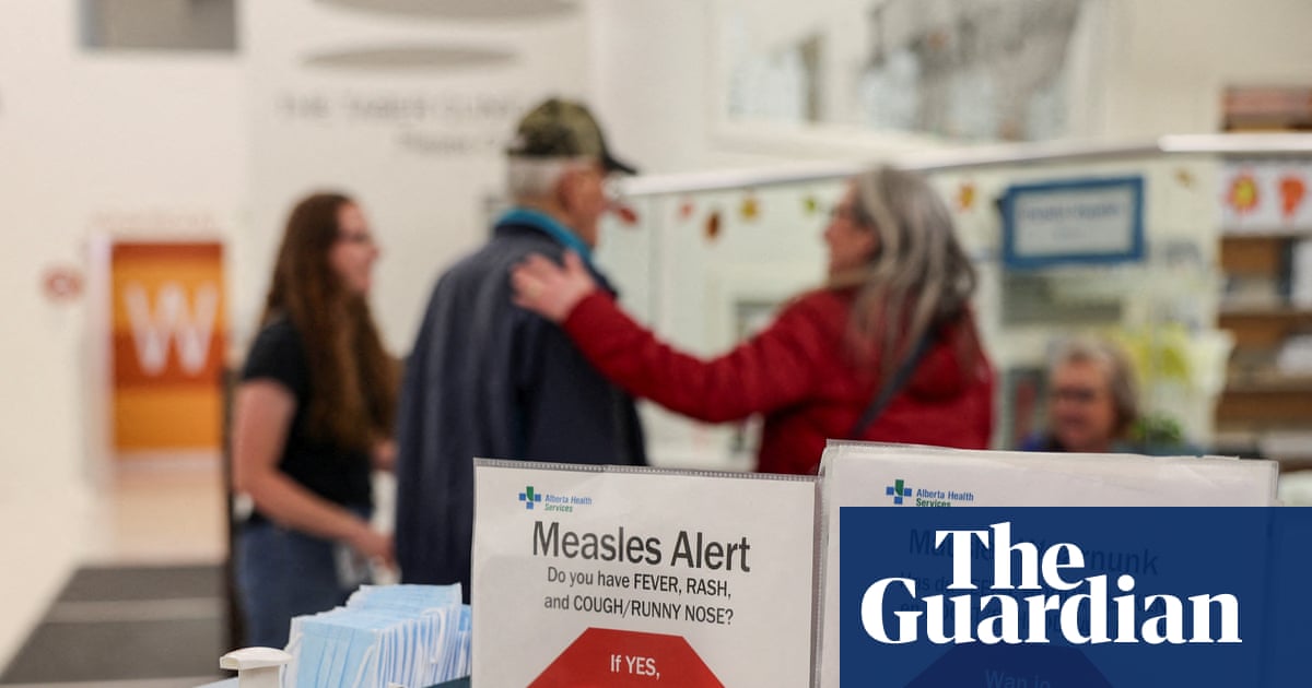 Canada no longer measles-free as outbreaks spread | Canada