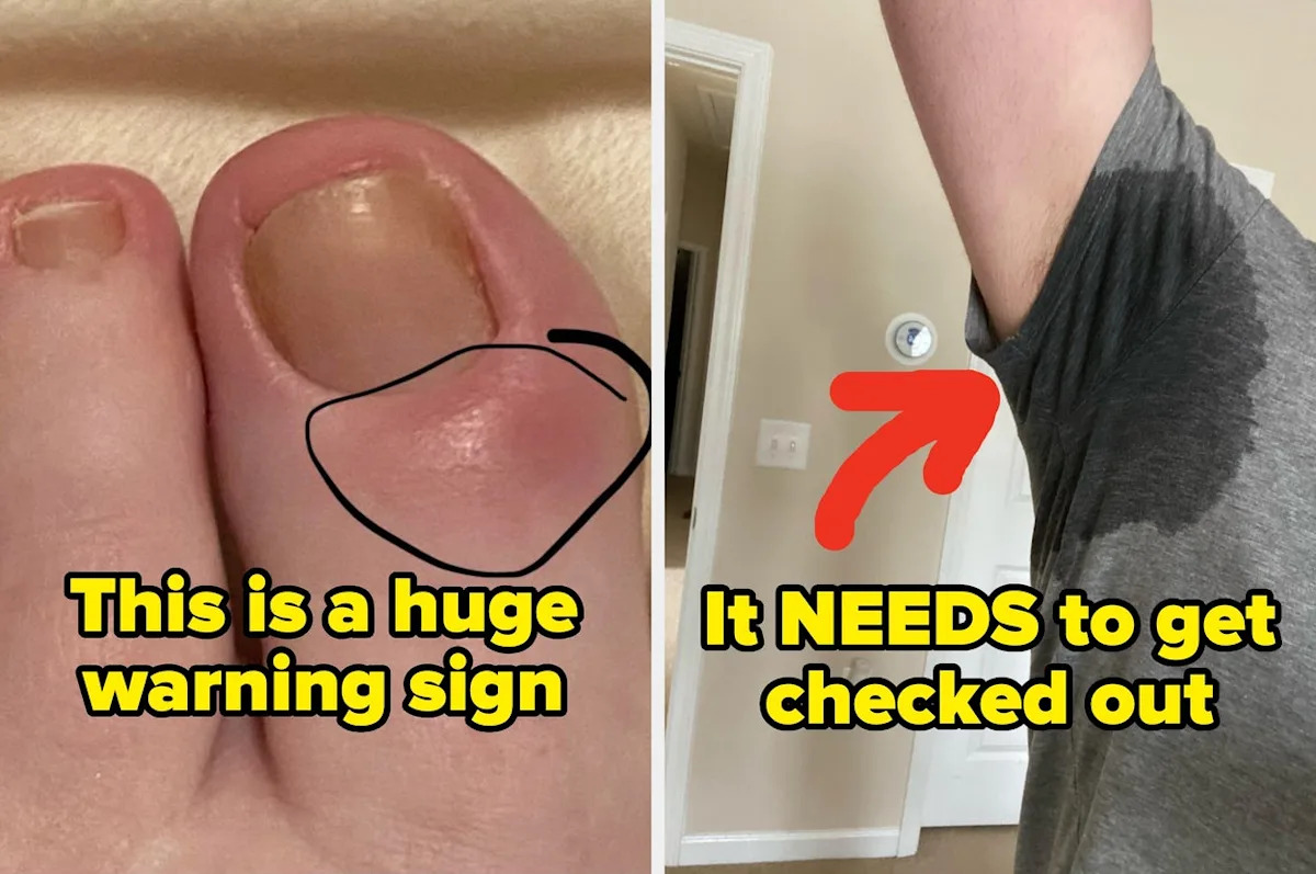 Medical Professionals Are Revealing The "Small" Health Signs You Should Never, Ever Ignore